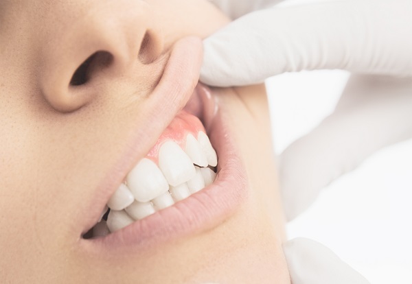 La santé bucco-dentaire est un indicateur et un facteur important de la santé globale (Visuel Adobe Stock 84742781)