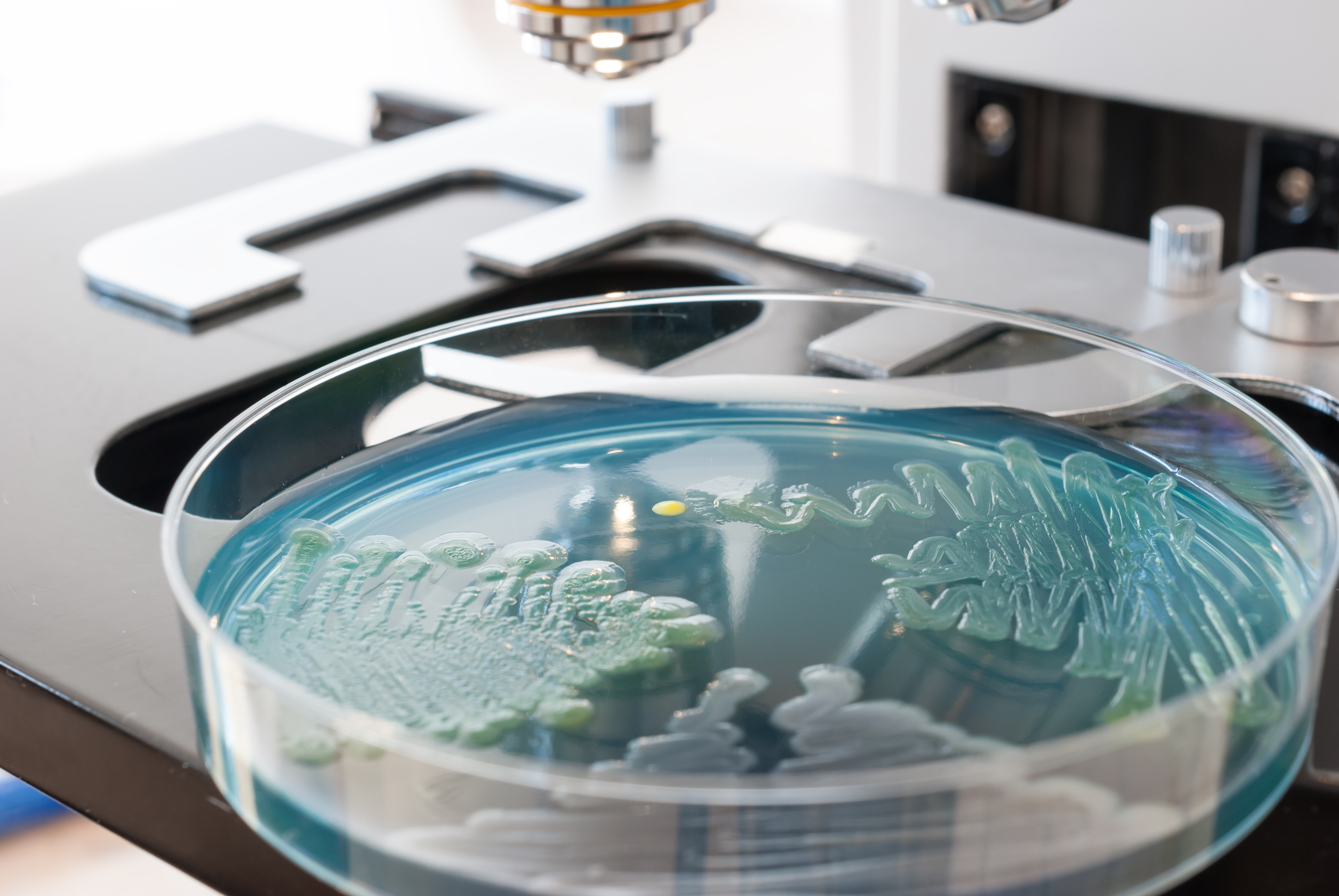 Le problème de la résistance antimicrobienne pourrait devenir catastrophique et irréversible d'ici 2050, tuant près de 10 millions de personnes chaque année (Visuel Adobe Stock 85264602) Le problème de la résistance antimicrobienne pourrait devenir catastrophique et irréversible d'ici 2050, tuant près de 10 millions de personnes chaque année (Visuel Adobe Stock 85264602)