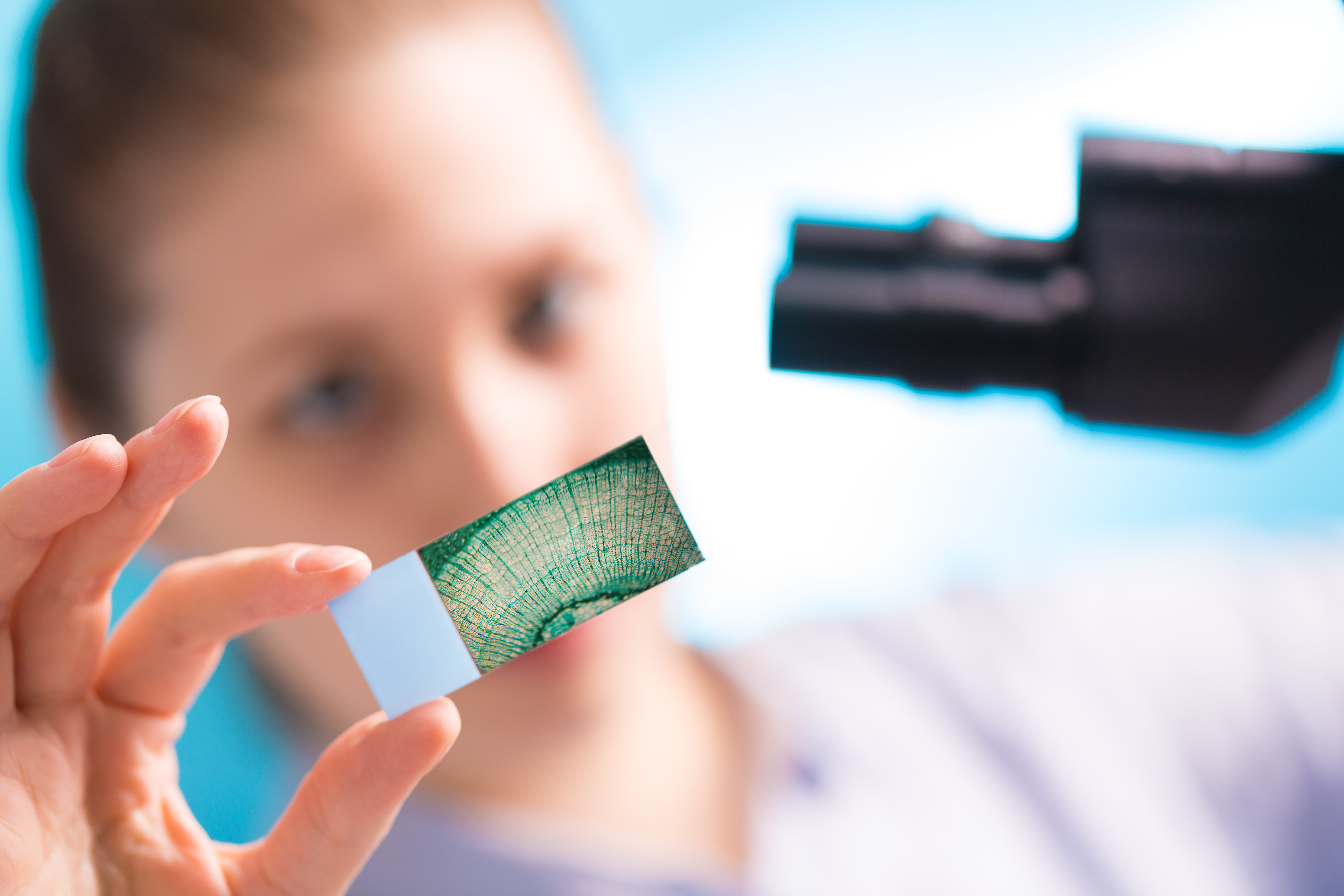Ces oncologues appellent ainsi à une meilleure éducation des patientes, mais aussi des cliniciens, à la détection de ce type de cancer relativement rare mais très agressif. (Visuel Adobe Stock 85526126) Ces oncologues appellent ainsi à une meilleure éducation des patientes, mais aussi des cliniciens, à la détection de ce type de cancer relativement rare mais très agressif. (Visuel Adobe Stock 85526126)