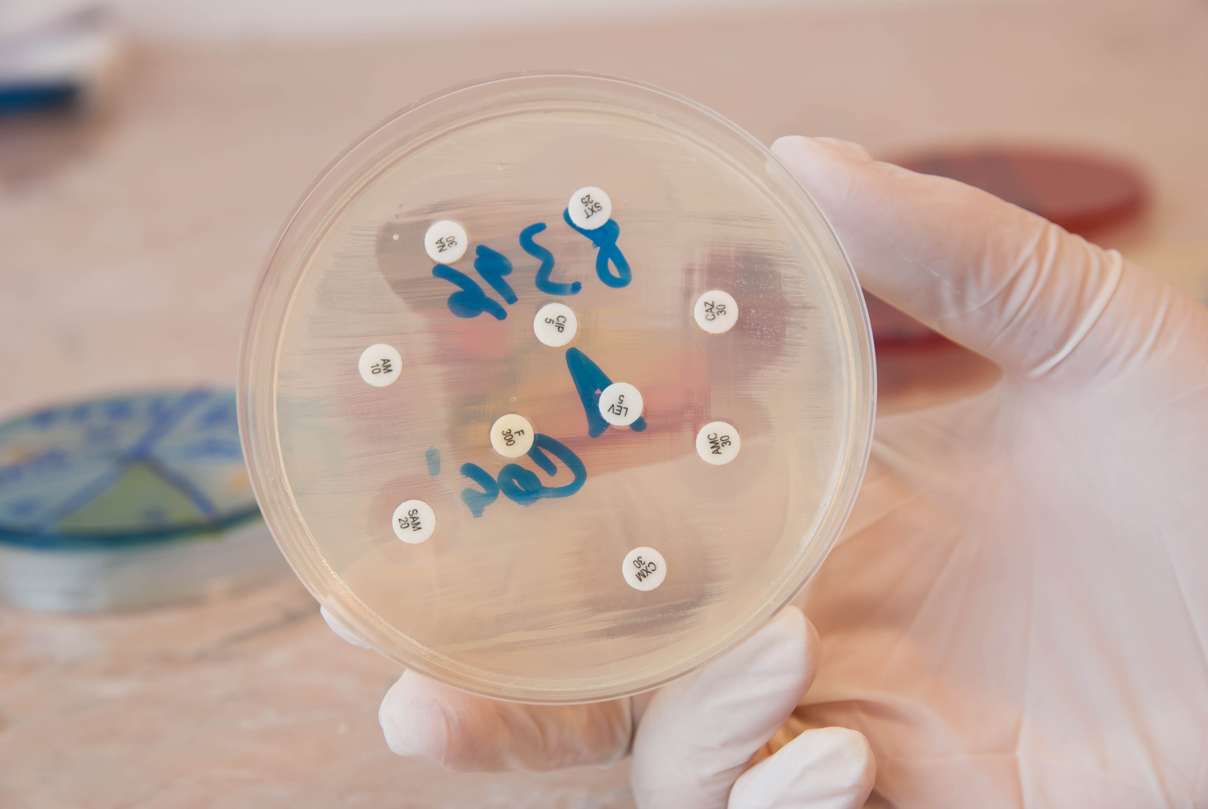 Une molécule appelée « pSma1 » présente dans des échantillons de cellules bactériennes patients atteints de colite ulcéreuse sévère est retrouvée dans certaines souches de Campylobacter concisus (C. concisus), une bactérie qui vit habituellement dans la bouche (Visuel Adobe Stock 95277279)