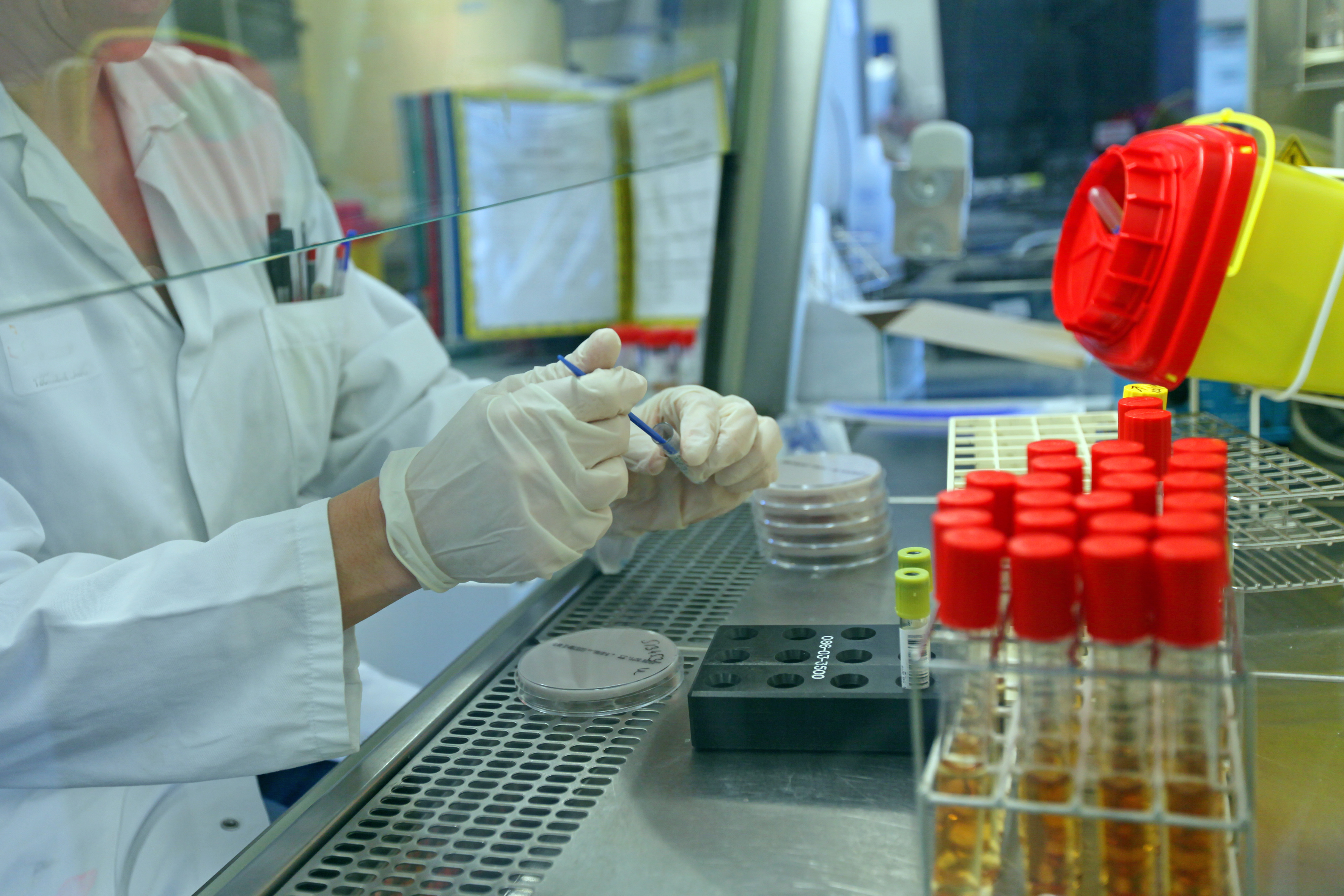 Certains antidépresseurs pourraient contribuer à traiter plusieurs maladies infectieuses Certains antidépresseurs pourraient contribuer à traiter plusieurs maladies infectieuses