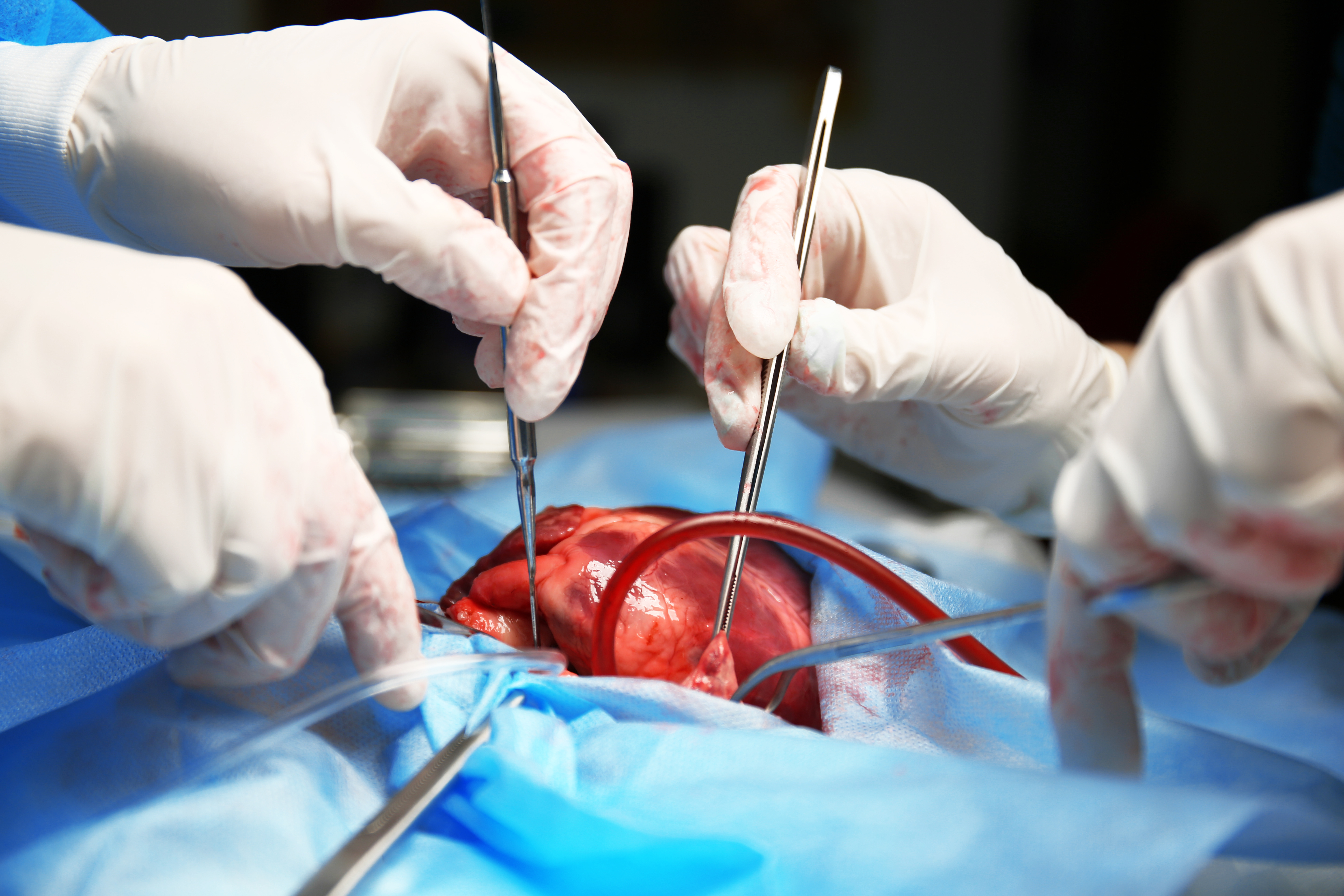 Quels progrès en matière de réparation et régénération cardiaques après un infarctus du myocarde ? (Visuel Adobe Stock 99129205) 