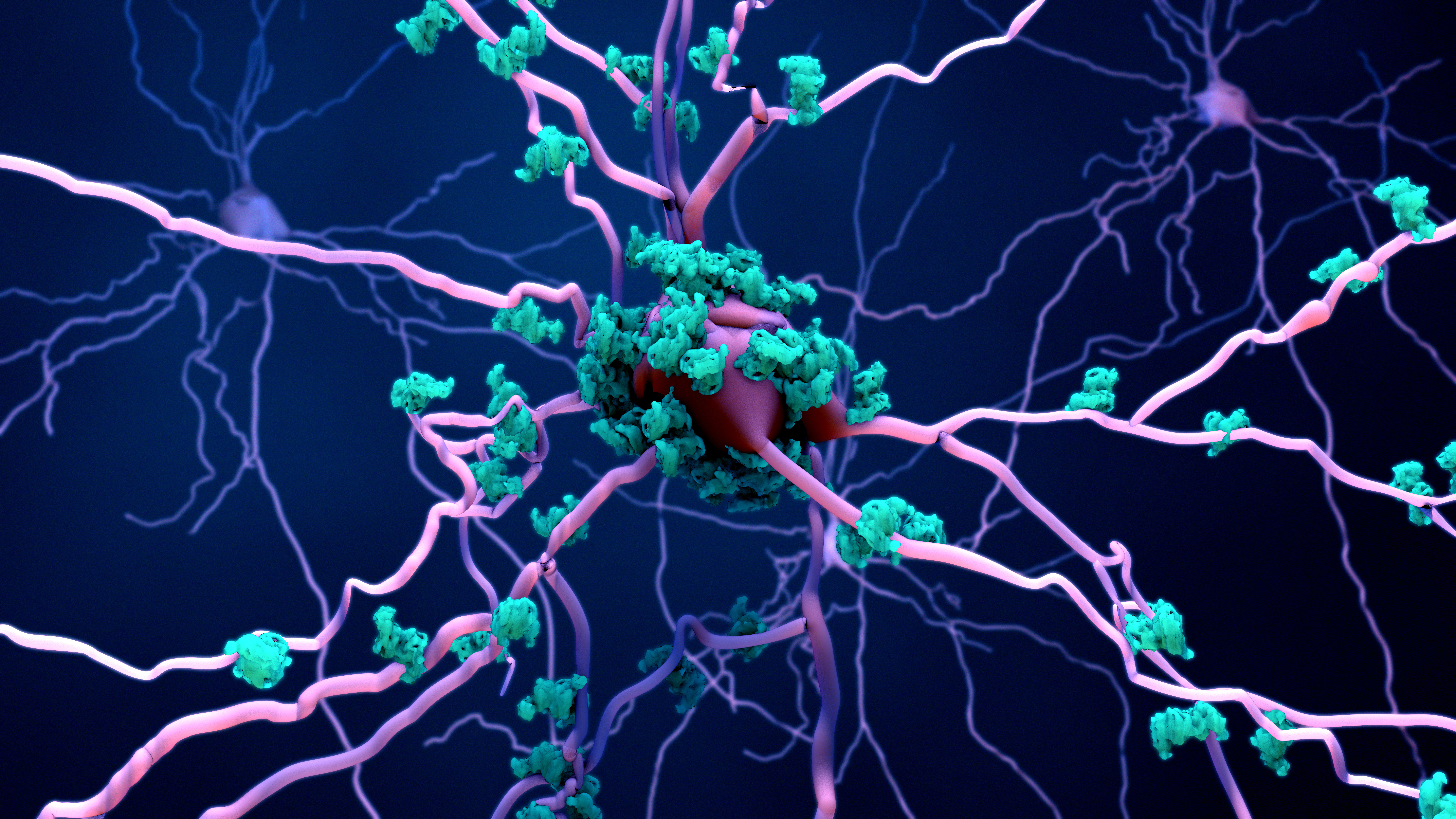 L'étude confirme un début précoce et en profondeur de la maladie d'Alzheimer dans le cerveau