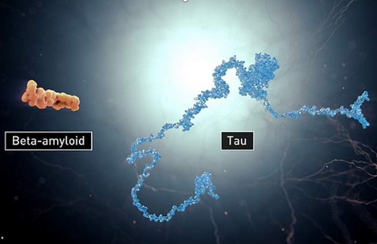 Si, après 20 années sans innovation thérapeutique, un nouveau médicament « anti-amyloïde » pour le traitement de la maladie d’Alzheimer vient tout juste d’être approuvé en « fast track » par l’Agence FDA, cette recherche cible l’autre protéine toxique impliqué, tau (Visuel NIA)