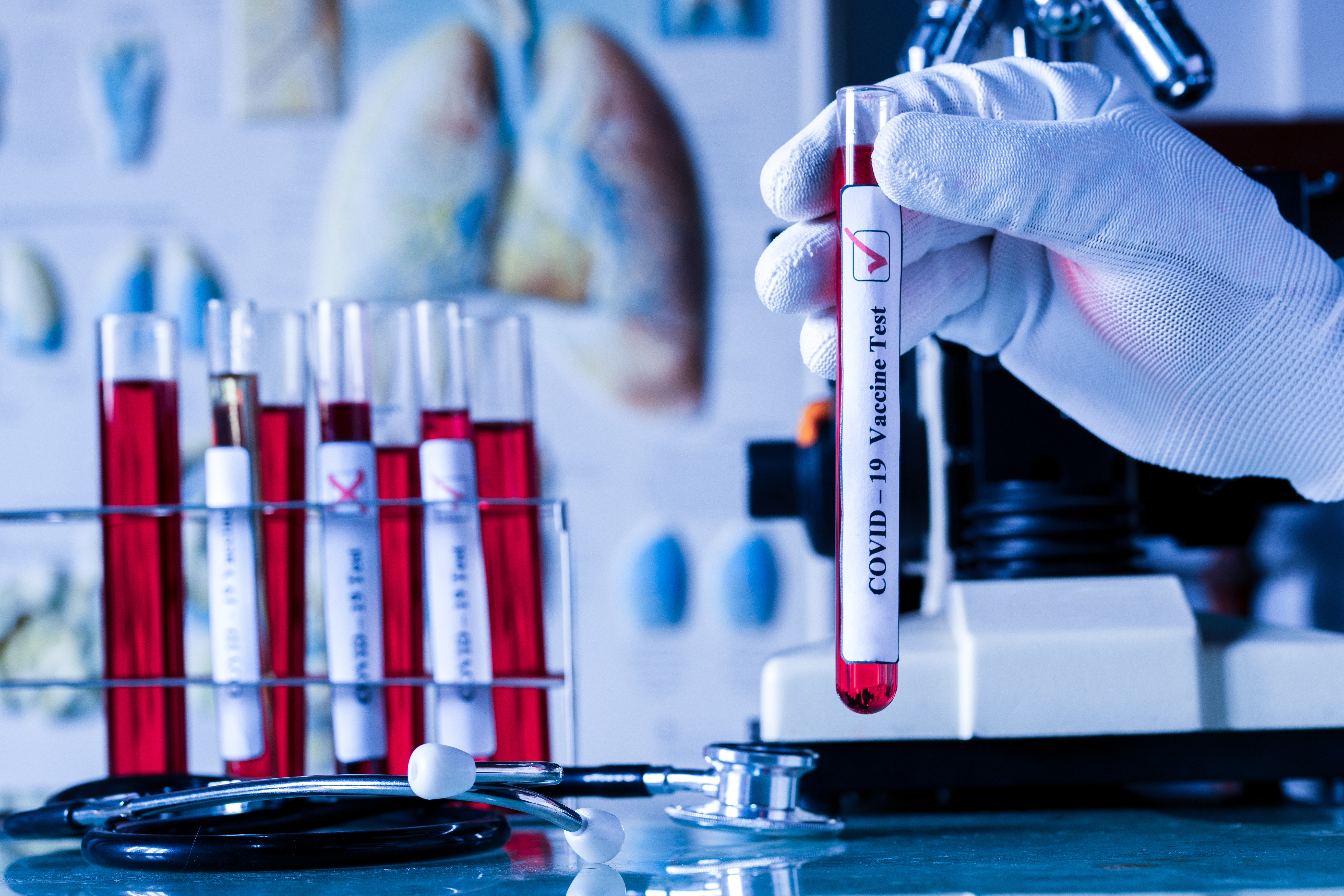 COVID : le niveau de protection des anticorps contre la réinfection, la durée de la réponse immunitaire et le taux de déclin des anticorps induits ne sont toujours pas connus (Visuel AdobeStock_332945564) COVID : le niveau de protection des anticorps contre la réinfection, la durée de la réponse immunitaire et le taux de déclin des anticorps induits ne sont toujours pas connus (Visuel AdobeStock_332945564)