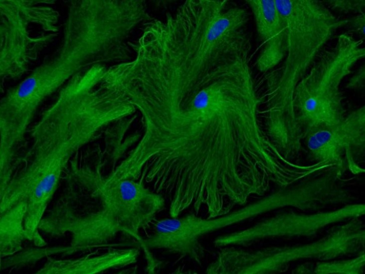 Si les astrocytes ont longtemps été considérées comme de simples cellules de soutien des neurones, ces travaux d’une équipe française leur attribuent un rôle décisif dans le développement cognitif (Visuel © Inserm/Ruiz, Anne-Laure) Si les astrocytes ont longtemps été considérées comme de simples cellules de soutien des neurones, ces travaux d’une équipe française leur attribuent un rôle décisif dans le développement cognitif (Visuel © Inserm/Ruiz, Anne-Laure).