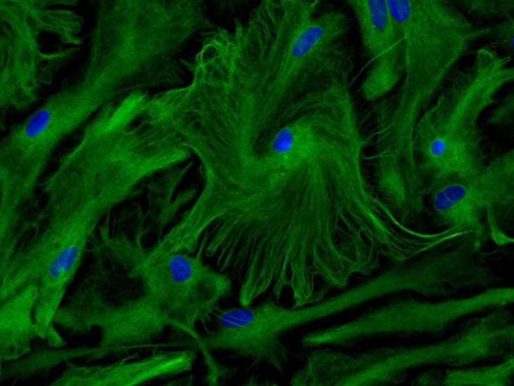 Si les astrocytes ont longtemps été considérées comme de simples cellules de soutien des neurones, ces travaux d’une équipe française leur attribuent un rôle décisif dans le développement cognitif (Visuel © Inserm/Ruiz, Anne-Laure).