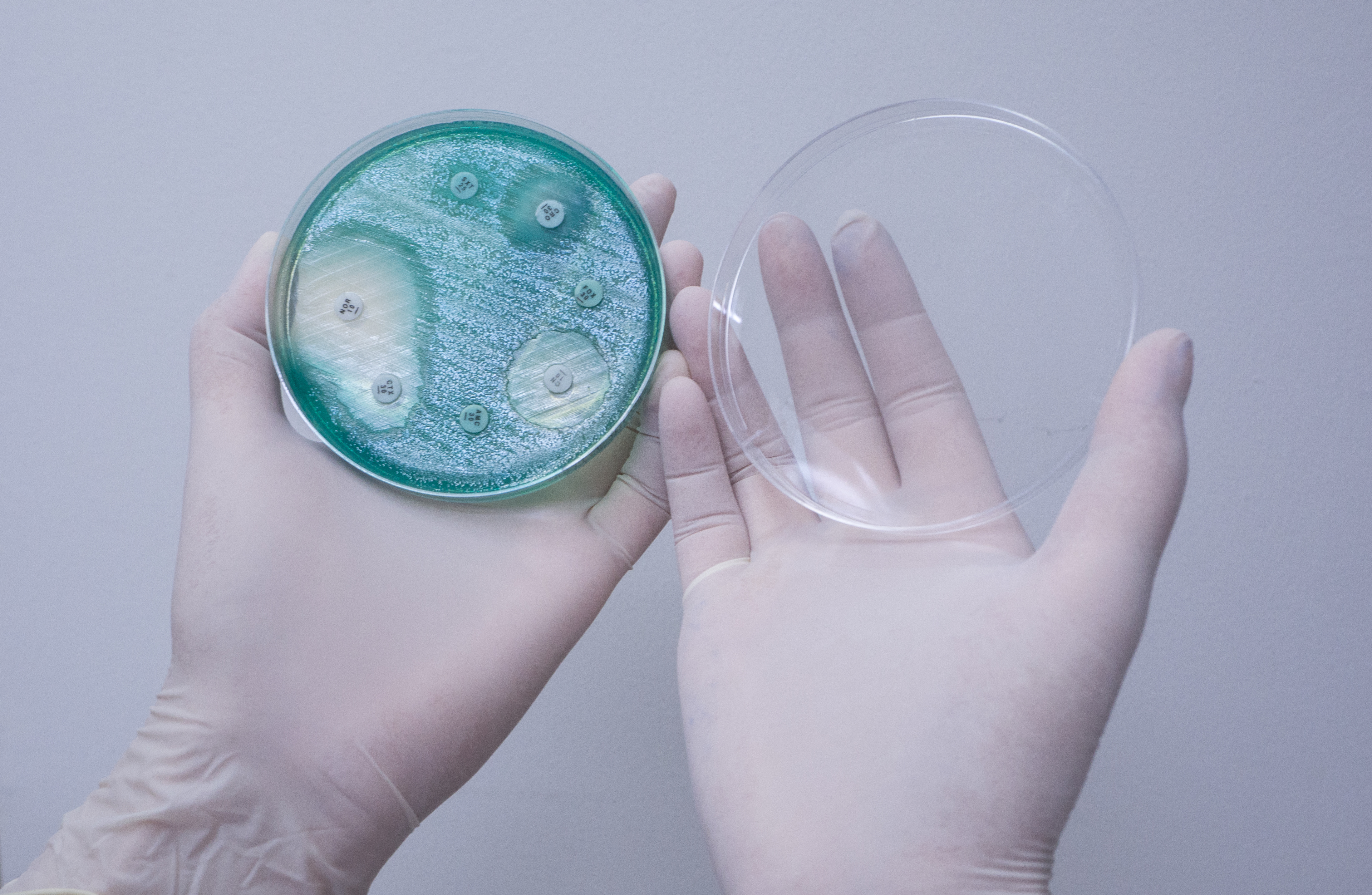 A quoi les microbiomes de nos ancêtres pouvaient-ils ressembler et comment ont-ils donc évolué ? A quoi les microbiomes de nos ancêtres pouvaient-ils ressembler et comment ont-ils donc évolué ?