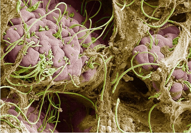 Le stress et le microbiome intestinal -via les bactéries filamenteuses segmentées sur visuel-  jouent un rôle clé dans le déclenchement des crises vaso-occlusives chez les personnes atteintes de drépanocytose (Visuel NYU Grossman School of Medicine)