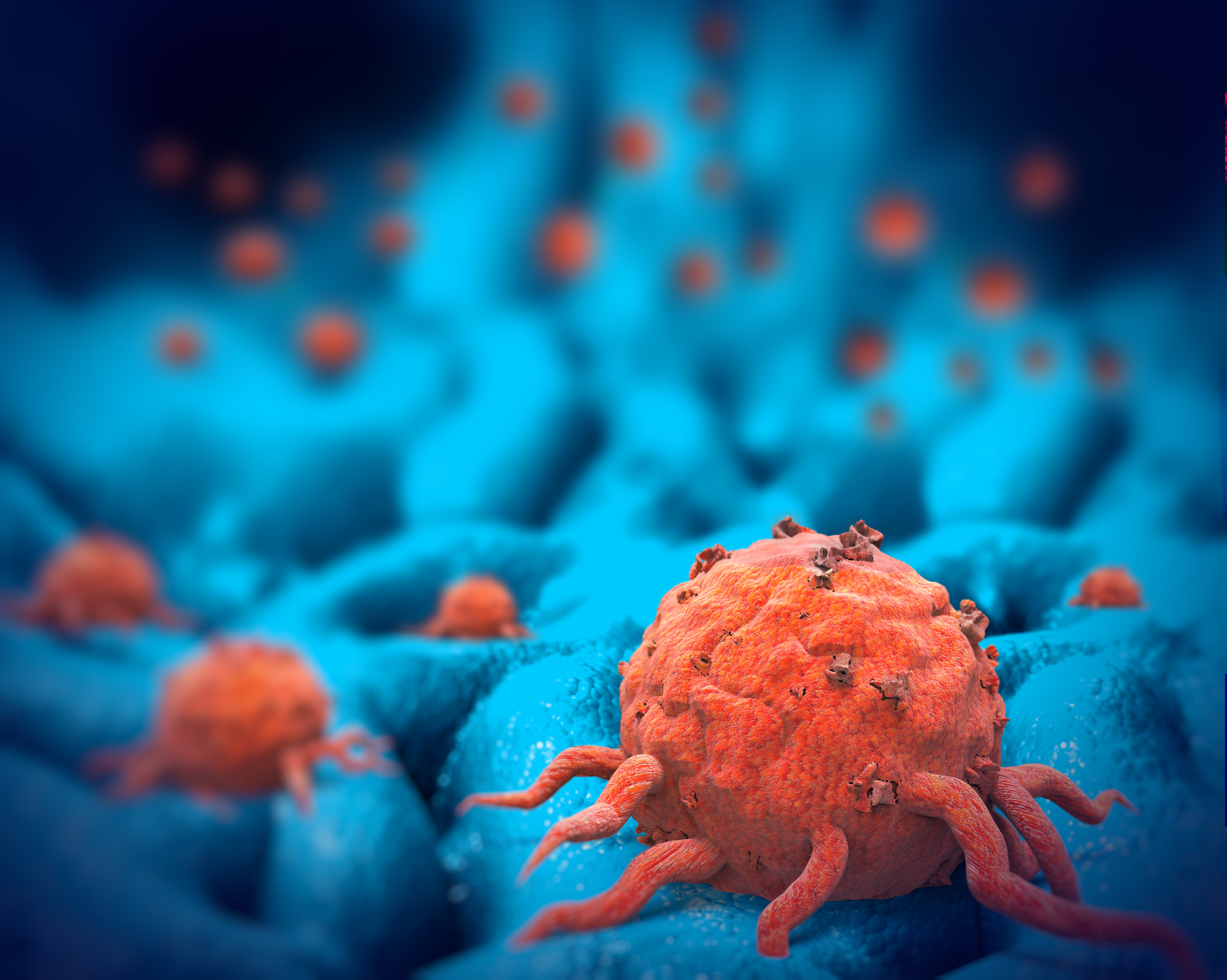 Metformine et rapamycine apparaissent déjà très prometteuses par rapport à une chimiothérapie d'entretien ou à une approche de surveillance dans le suivi du cancer du pancréas (Visuel AdobeStock_188877992) Metformine et rapamycine apparaissent déjà très prometteuses par rapport à une chimiothérapie d'entretien ou à une approche de surveillance dans le suivi du cancer du pancréas (Visuel AdobeStock_188877992)