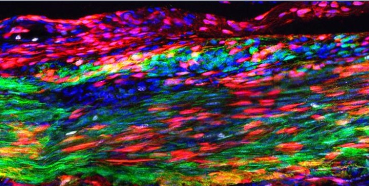 Les cellules souches « du tendon «  (en rouge sur visuel)