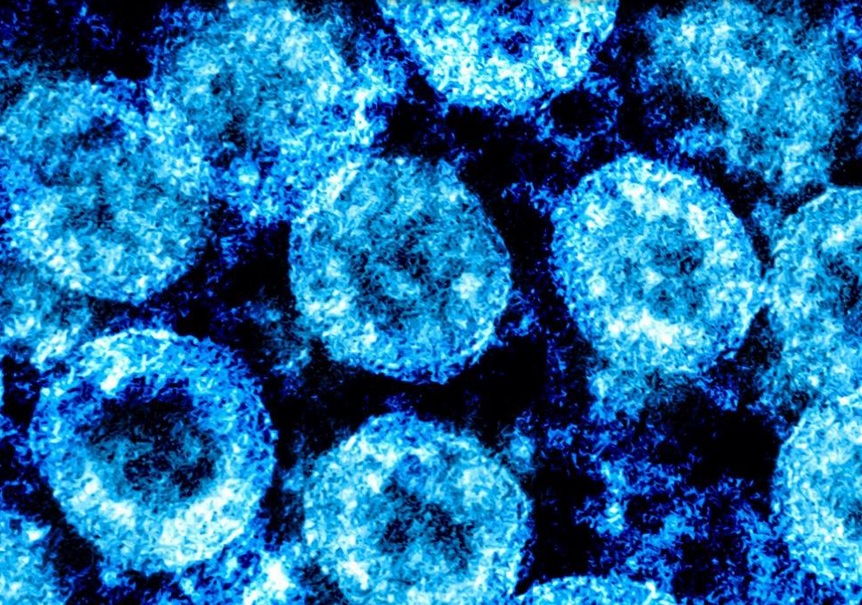 Ces évolutions pourraient permettre au virus d’échapper aux vaccins actuels (Visuel Columbia University Irving Medical Center)