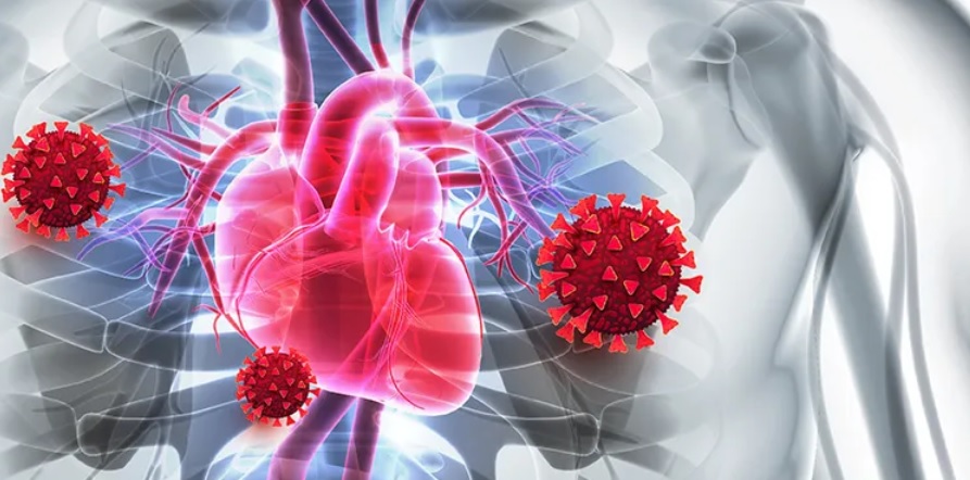 Chez les personnes déjà à risque cardiaque élevé, soit en raison d’un taux de cholestérol génétique élevé, soit d’une maladie cardiaque préexistante ou d’une athérosclérose, la maladie COVID-19 a augmenté de manière significative l’incidence de la crise cardiaque (Visuel FH Foundation) Chez les personnes déjà à risque cardiaque élevé, soit en raison d’un taux de cholestérol génétique élevé, soit d’une maladie cardiaque préexistante ou d’une athérosclérose, la maladie COVID-19 a augmenté de manière significative l’incidence de la crise cardiaque (Visuel FH Foundation)