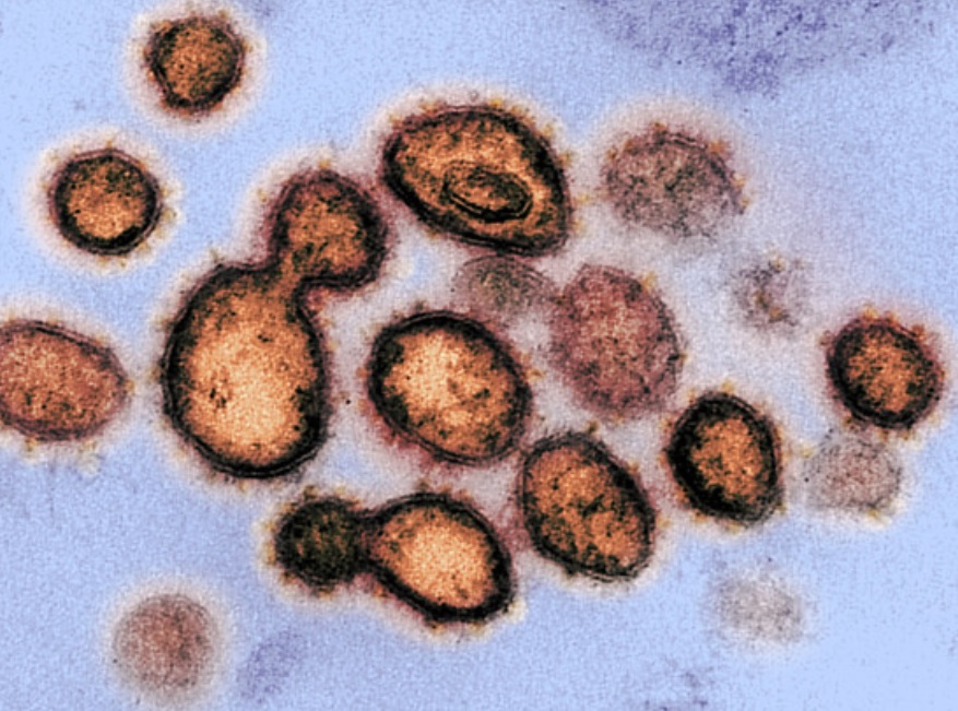 L’épidémie de pneumonie atypique associée à l’infection au nouveau coronavirus COVID-19 (ex 2019-nCoV) poursuit sa propagation avec près de 79.000 cas confirmés, près de 2.500 décès recensés (Source GISAID)-et 12 cas confirmés en France 