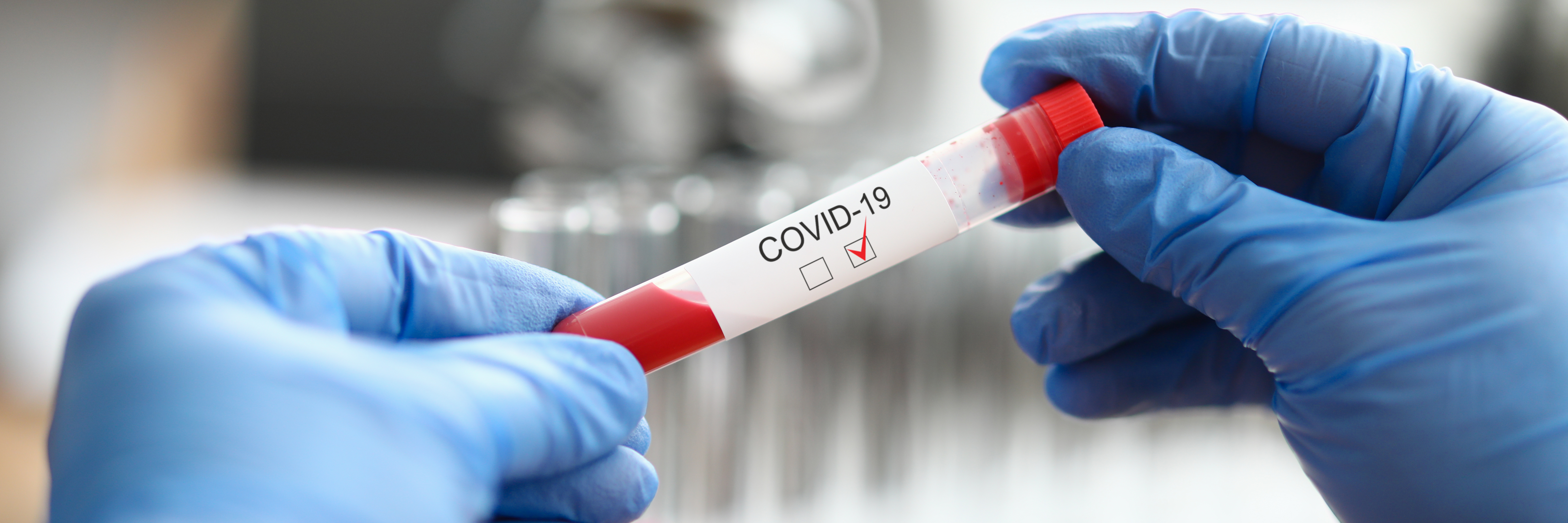 Chez le singe, l'infection primaire par le SRAS-CoV-2 pourrait apporter une protection contre les expositions ultérieures.