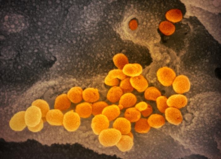Les animaux traités par le nouvel antiviral ont 100 fois moins de virus infectieux dans leurs poumons que le groupe témoin (Visuel NIAID) Les animaux traités par le nouvel antiviral ont 100 fois moins de virus infectieux dans leurs poumons que le groupe témoin (Visuel NIAID)
