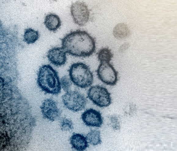 Le nouveau coronavirus est au moins aussi transmissible que le virus SRAS