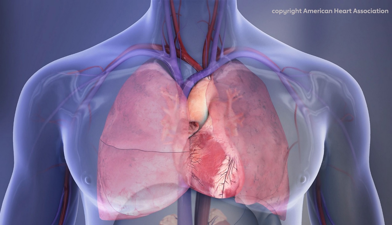 Le risque de crise cardiaque augmente avec l’âge chez les personnes vivant avec le VIH et l'hépatite C (Visuel copyright American Heart Association)