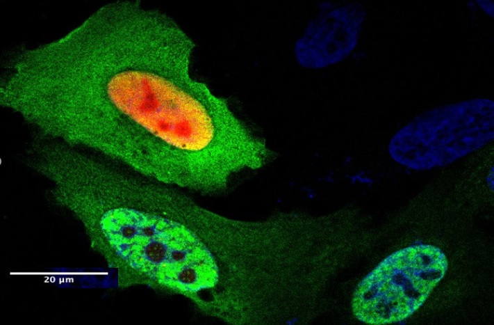 Maintenir le bon fonctionnement de DAXX (en rouge) va permettre d’éviter l'enchevêtrement ou l’agrégation des protéines toxiques caractéristiques des maladies neurodégénératives (Visuel Xiaolu Yang, PhD) 