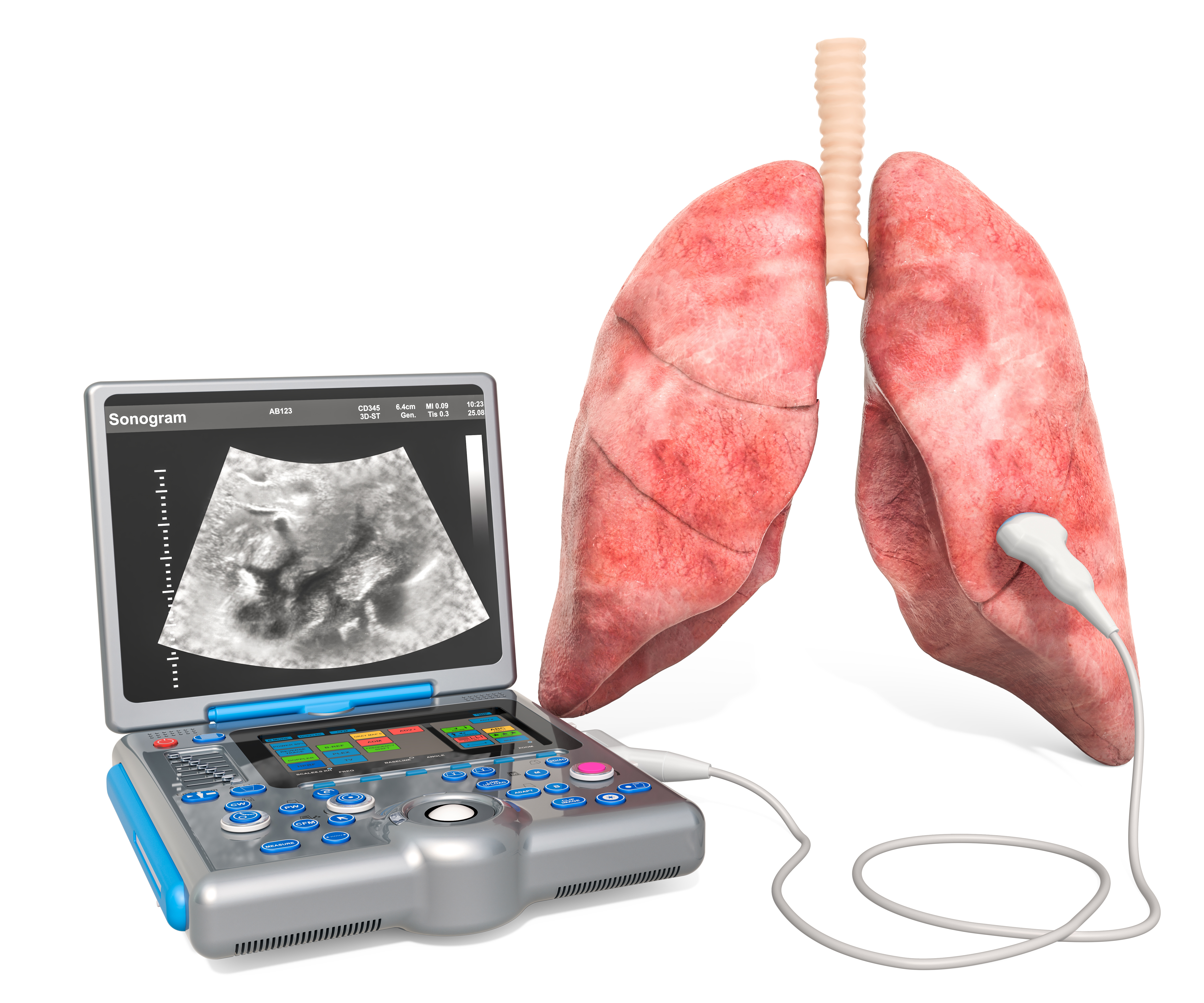 L’échographie pulmonaire en complément du scanner précise la sévérité et la durée de la maladie (Visuel Adobe Stock 263779362)
