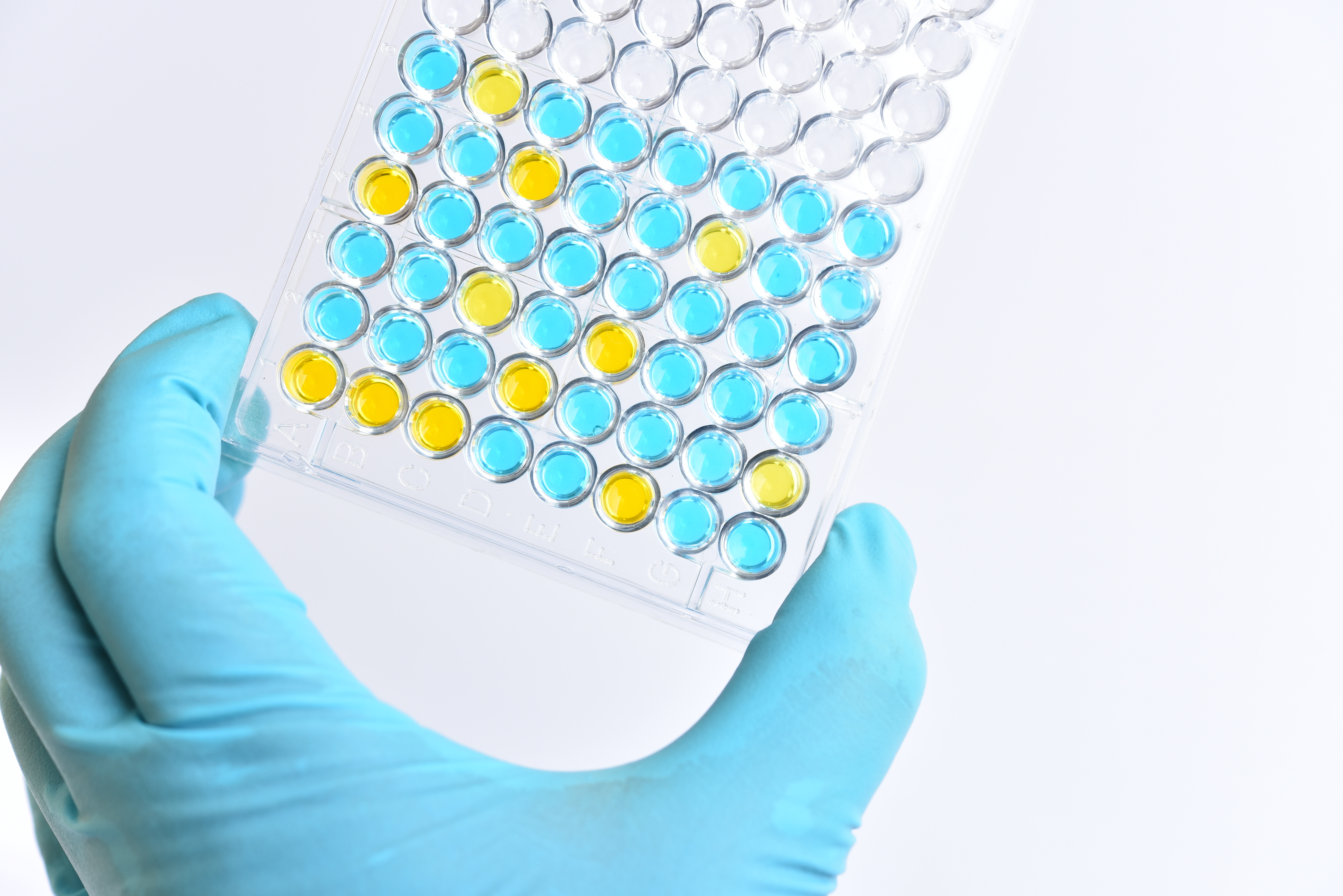 Des métallodrogues déjà disponibles pour traiter d’autres pathologies pourraient, en combinaison avec d’autres agents, supprimer la réplication du SRAS-CoV-2 et soulager les symptômes associés aux virus (Visuel Adobe Stock 340972951) Des métallodrogues déjà disponibles pour traiter d’autres pathologies pourraient, en combinaison avec d’autres agents, supprimer la réplication du SRAS-CoV-2 et soulager les symptômes associés aux virus (Visuel Adobe Stock 340972951)