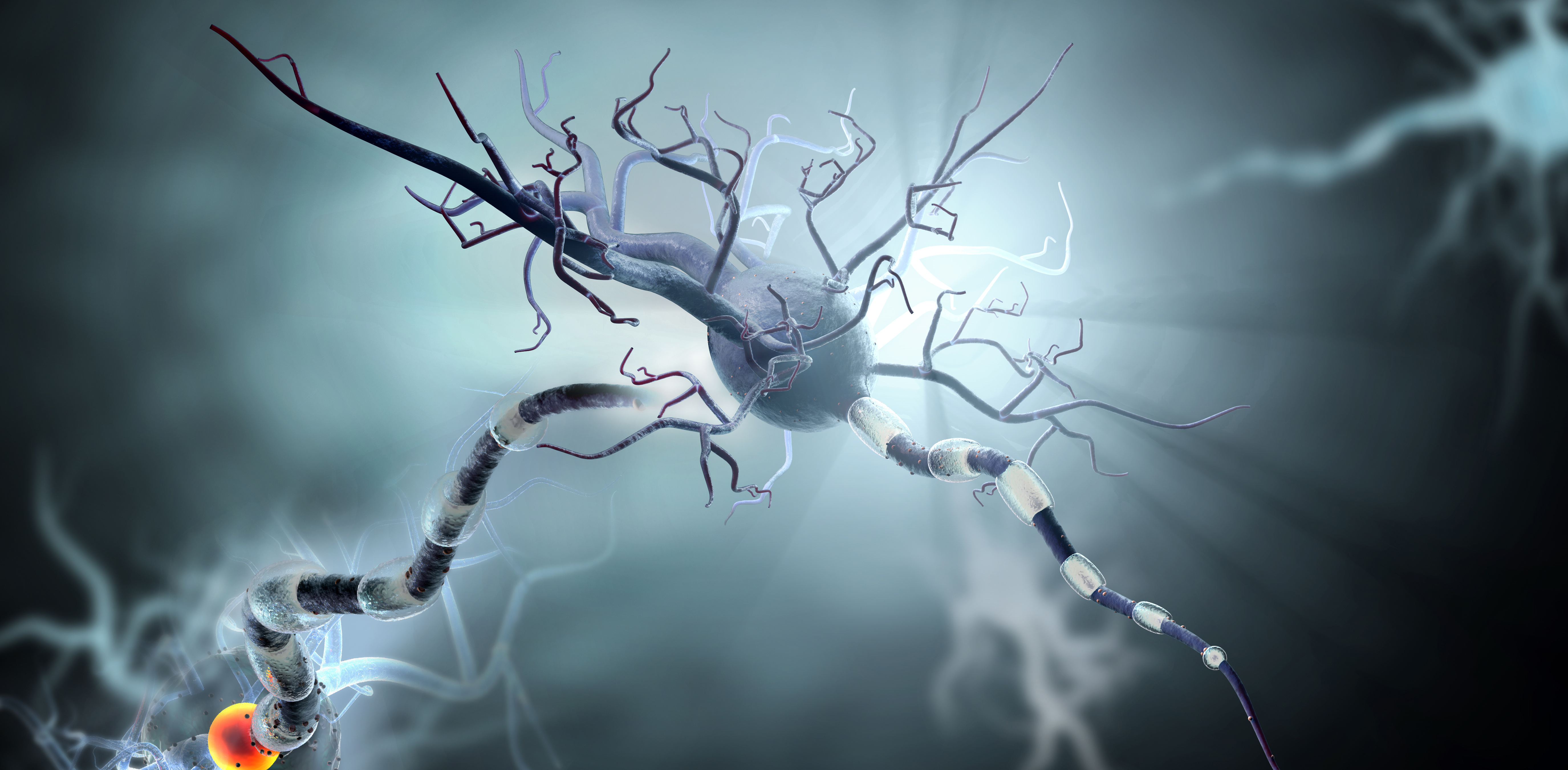 Des interneurones inhibiteurs, des cellules capables d'atténuer l'excitation des zones du cerveau et d'exercer ainsi une fonction de freinage, ne fonctionnent plus chez les patients épileptiques