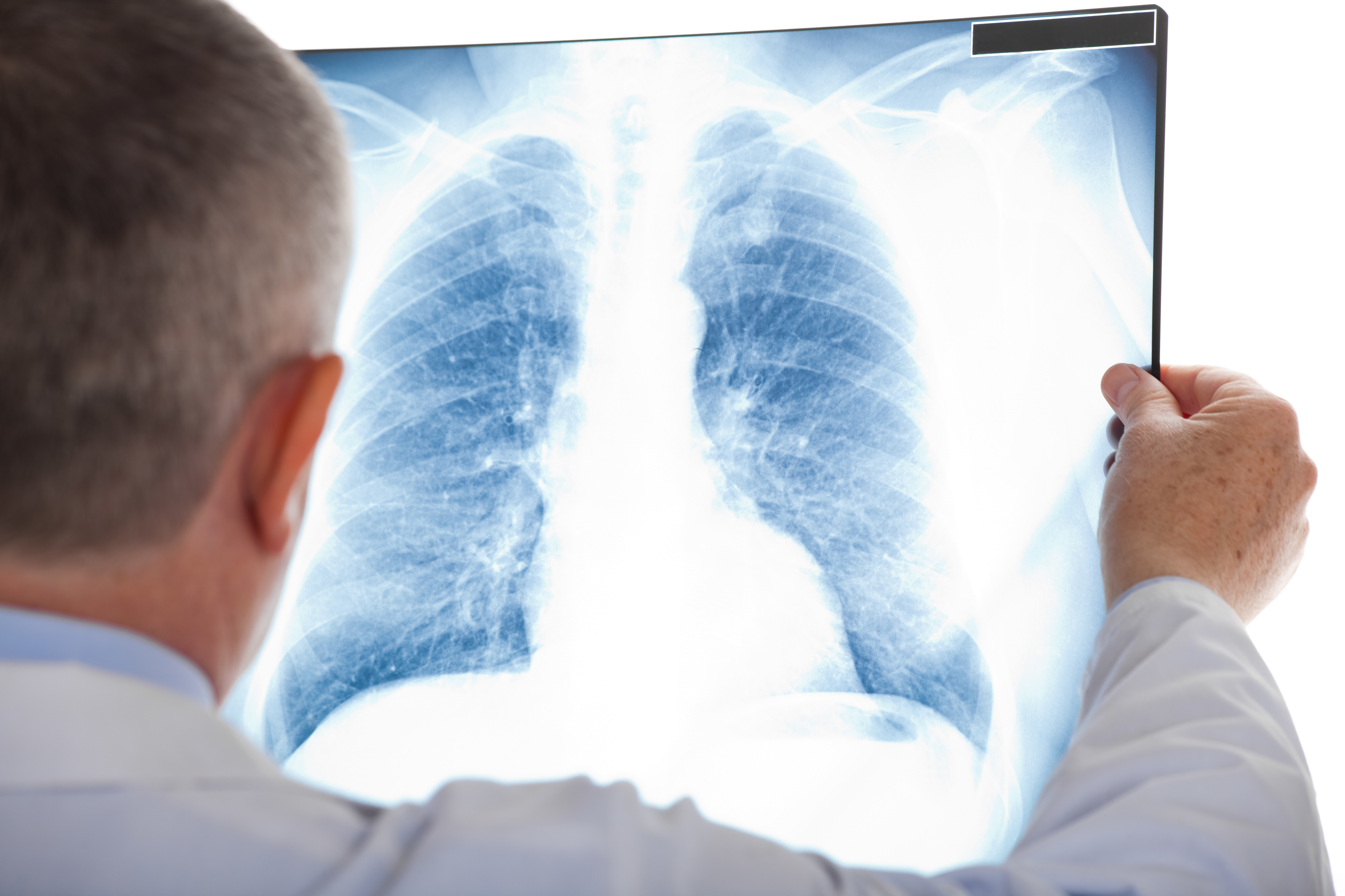 Des fibroblastes exposés à des e-liquides contenant de la nicotine présentent une viabilité accrue, des concentrations plus élevées de nicotine conduisant à une plus grande vitalité encore. Des fibroblastes exposés à des e-liquides contenant de la nicotine présentent une viabilité accrue, des concentrations plus élevées de nicotine conduisant à une plus grande vitalité encore.