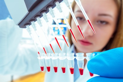 Le cancer de la prostate est le premier cancer non cutané, diagnostiqué chez les hommes. Le cancer de la prostate est le premier cancer non cutané, diagnostiqué chez les hommes.