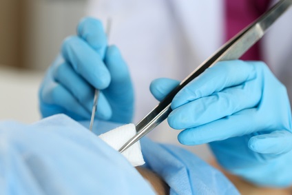 Une suture intelligente permettant de réduire le risque d'infection et de simplifier la surveillance post-opératoire (Visuel Fotolia 111955243) Une suture intelligente permettant de réduire le risque d'infection et de simplifier la surveillance post-opératoire (Visuel Fotolia 111955243)
