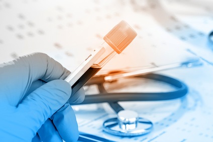 Avec certains traitements, la réduction du C-LDL peut être sévère et le C-LDL peut atteindre des niveaux inférieurs à 50 mg / dl ou même à 25 mg / dl. Avec certains traitements, la réduction du C-LDL peut être sévère et le C-LDL peut atteindre des niveaux inférieurs à 50 mg / dl ou même à 25 mg / dl.