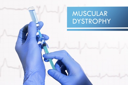 Le blocage des sphingolipides, un groupe de lipides bioactifs, permet de neutraliser, en désarmant plusieurs voies pathogéniques à la fois, le développement de la myopathie de Duchenne (Visuel Fotolia 122814082)