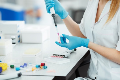 C’est une dernière génération de test sanguin, basé sur le principe de « biopsie liquide », c’est-à-dire qui analyse l'ADN circulant dans le sang et qui révèle ici à l’ASCO un potentiel de détection précoce du cancer du poumon. C’est une dernière génération de test sanguin, basé sur le principe de « biopsie liquide », c’est-à-dire qui analyse l'ADN circulant dans le sang et qui révèle ici à l’ASCO un potentiel de détection précoce du cancer du poumon.