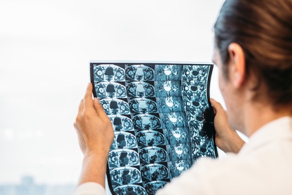 Quel âge ont vos os ? Quelles pourront être, en fonction de votre âge, votre sexe et votre état de santé, les conséquences d’une fracture sur le risque de décès ? (Visuel Fotolia 189406842) Quel âge ont vos os ? Quelles pourront être, en fonction de votre âge, votre sexe et votre état de santé, les conséquences d’une fracture sur le risque de décès ? (Visuel Fotolia 189406842)