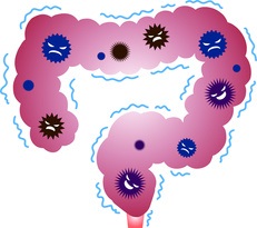 Dans le cancer du pancréas, les bactéries intestinales déterminent la vitesse de croissance tumorale