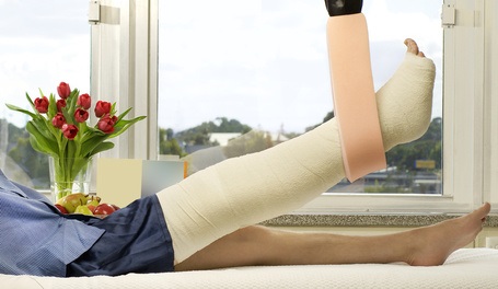 Ce bandage « osseux » est conçu pour capturer et piéger une molécule pro-cicatrisante, l'adénosine, sur le site de la fracture Ce bandage « osseux » est conçu pour capturer et piéger une molécule pro-cicatrisante, l'adénosine, sur le site de la fracture