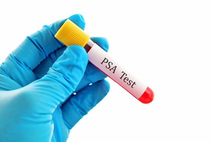 Le d&eacute;pistage par dosage du PSA (antig&egrave;ne sp&eacute;cifique de la prostate) r&eacute;duit probablement le risque de d&eacute;c&egrave;s par cancer de la prostate, avec une r&eacute;duction d'environ 2 d&eacute;c&egrave;s pour 1.000 hommes d&eacute;pist&eacute;s (Visuel Adobe Stock 98385407)