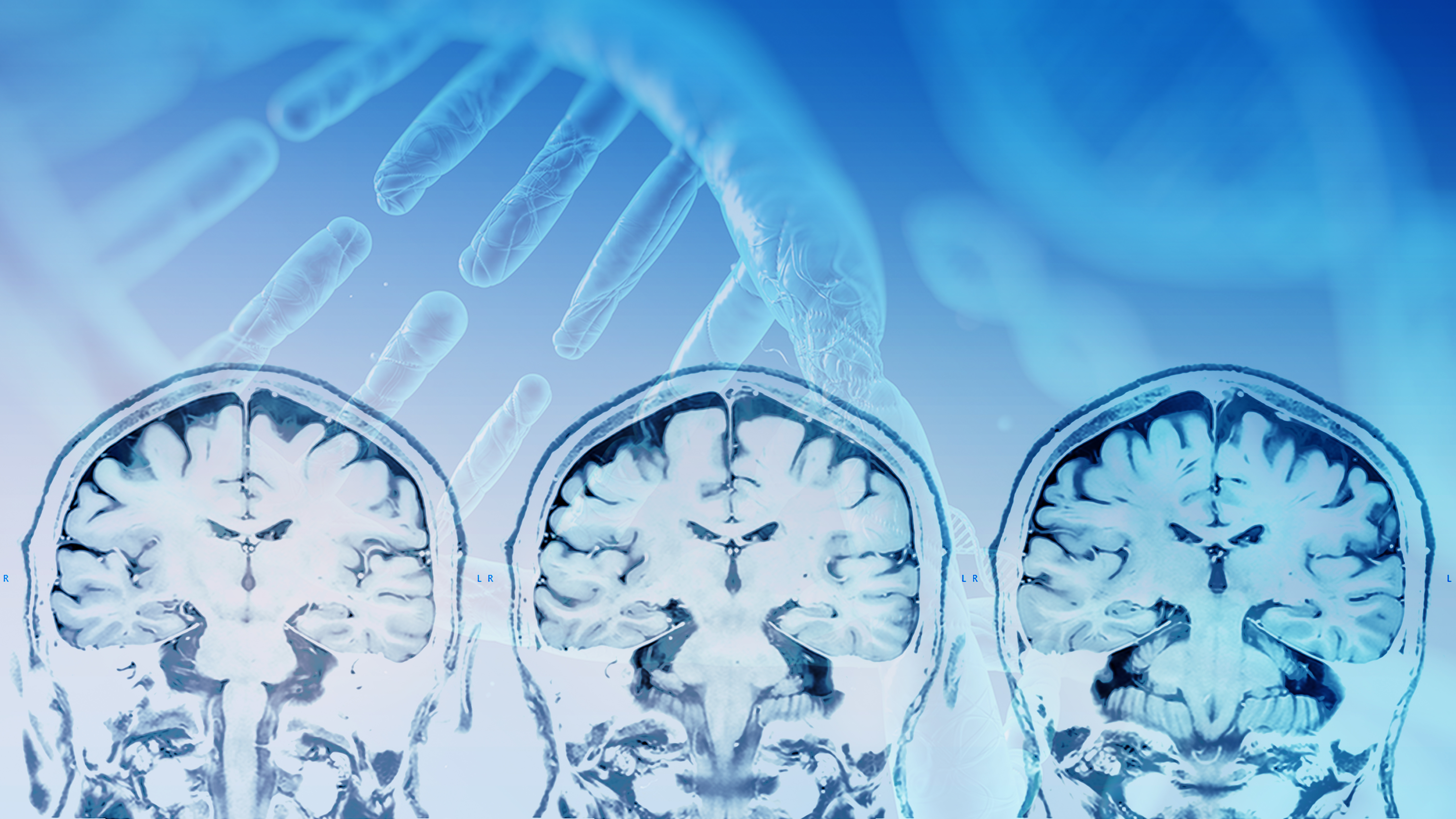 Foxp1 s’avère également impliqué dans le timing de la production de neurones dans le cerveau en développement.