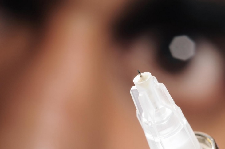 2 injections par an pourraient remplacer, pour le traitement du glaucome, les gouttes oculaires quotidiennes et la chirurgie (Visuel Gary Meek, Georgia Tech). 2 injections par an pourraient remplacer, pour le traitement du glaucome, les gouttes oculaires quotidiennes et la chirurgie (Visuel Gary Meek, Georgia Tech).