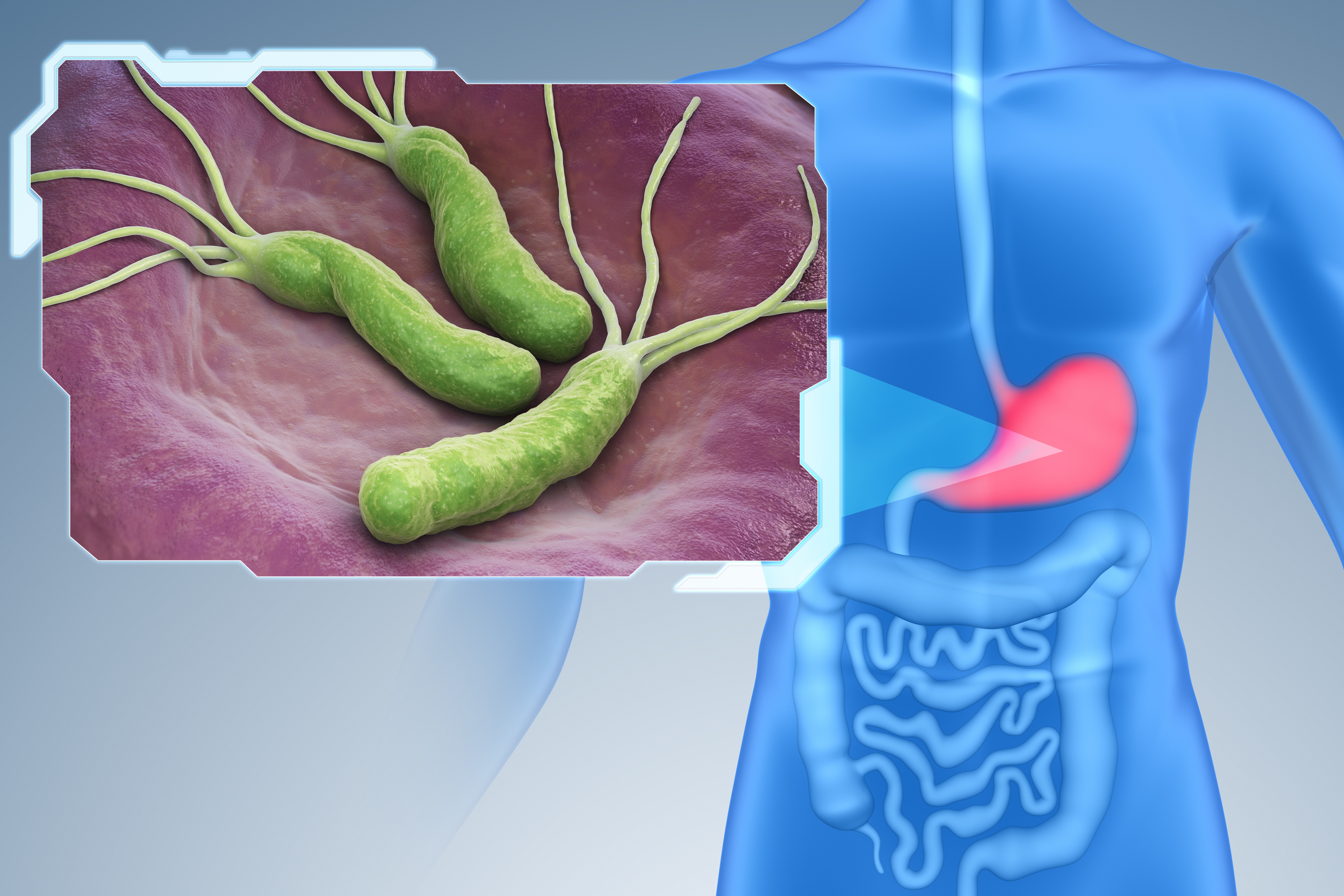 En France, le taux de résistance d'H pylori s'élève à 22,5%