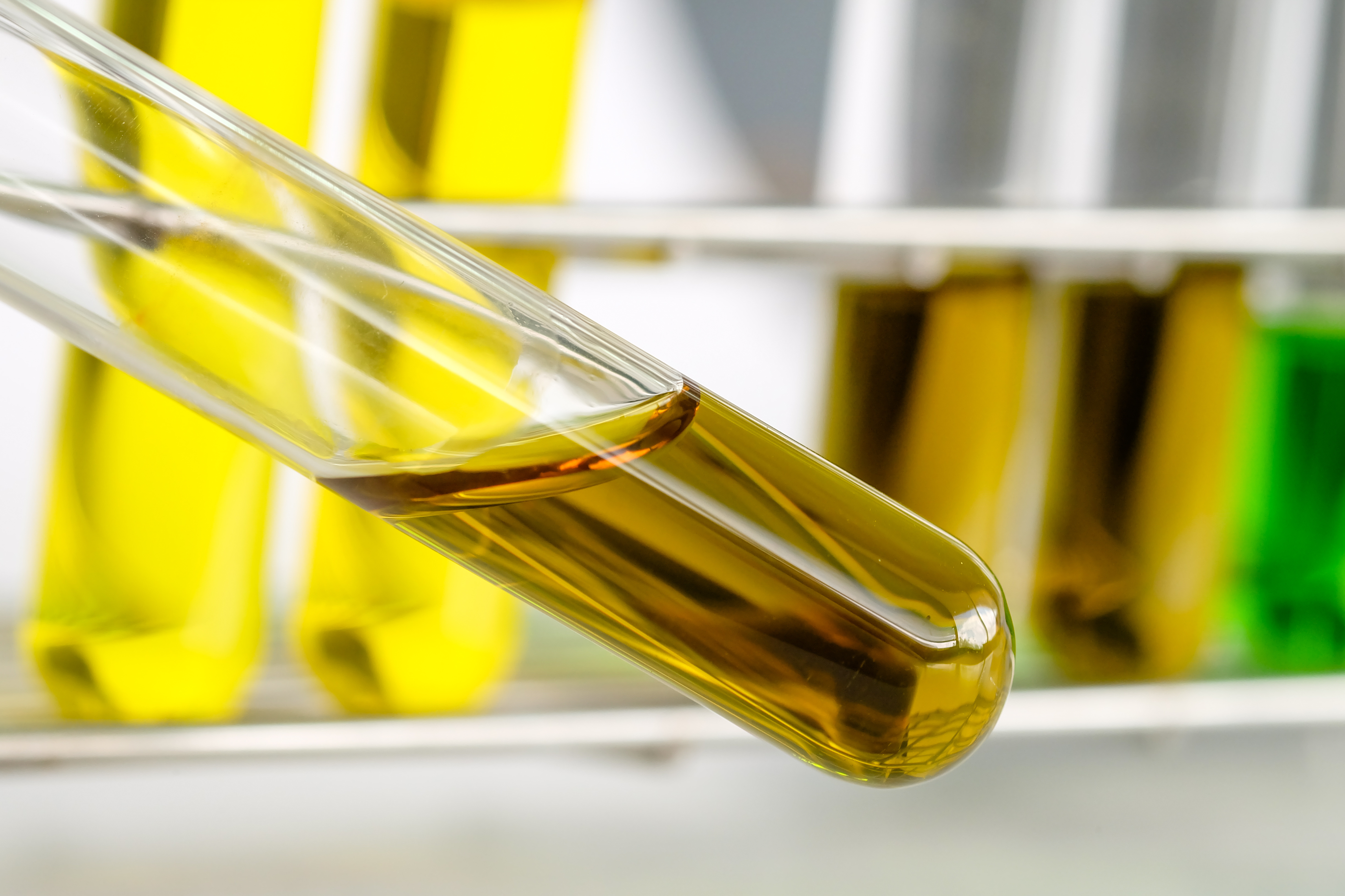 La réponse auto-immune en jeu dans la SEP pourrait être déclenchée par le manque d'un acide gras spécifique dans les tissus adipeux (Visuel Adobe Stock 299937062) La réponse auto-immune en jeu dans la SEP pourrait être déclenchée par le manque d'un acide gras spécifique dans les tissus adipeux (Visuel Adobe Stock 299937062)