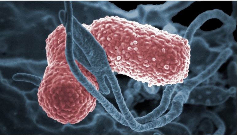 Les infections bactériennes à Klebsiella pneumoniae menaçant le pronostic vital qui se propagent en milieu hospitalier sont un sujet de préoccupation croissante avec une résistance croissante de ces bactéries aux antibiotiques. 