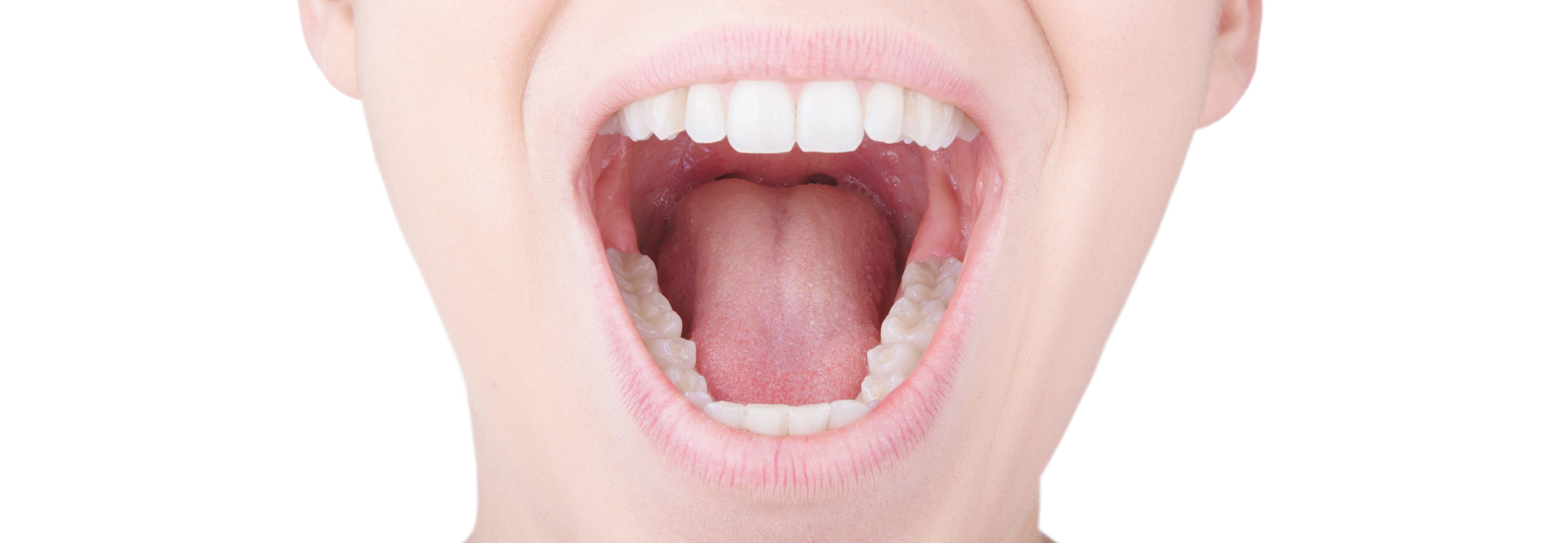 Le microbiote de la langue permet de détecter l’insuffisance cardiaque (Visuel AdobeStock_124787499)