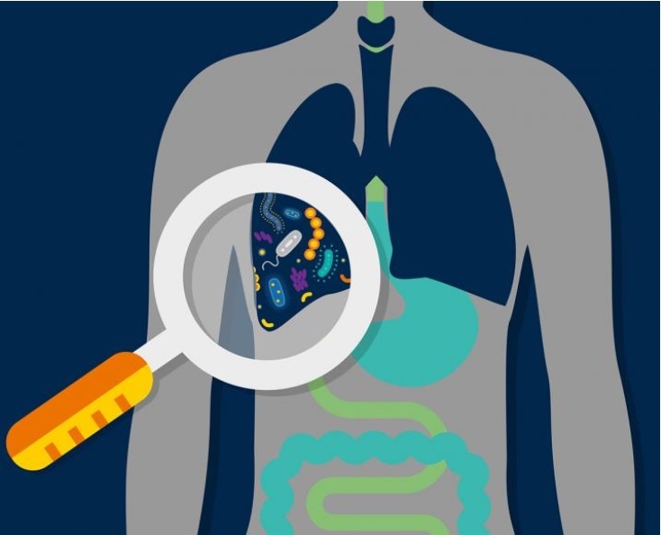 Des changements détectables dans le microbiome pulmonaire peuvent permettre de prédire dans quelle mesure les patients gravement malades vont répondre aux soins intensifs
