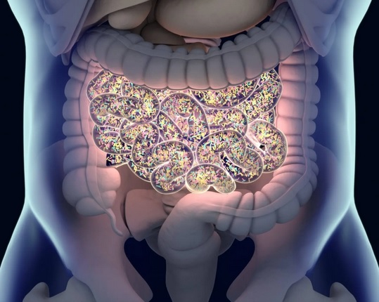 Quel lien possible entre la polyarthrite rhumatoïde et le microbiote intestinal ? Eh bien, il serait possible de prédire le pronostic d'un patient atteint de polyarthrite rhumatoïde en se concentrant sur les milliers de milliards de bactéries qui habitent son tractus ou microbiome intestinal (Visuel Mayo Clinic)