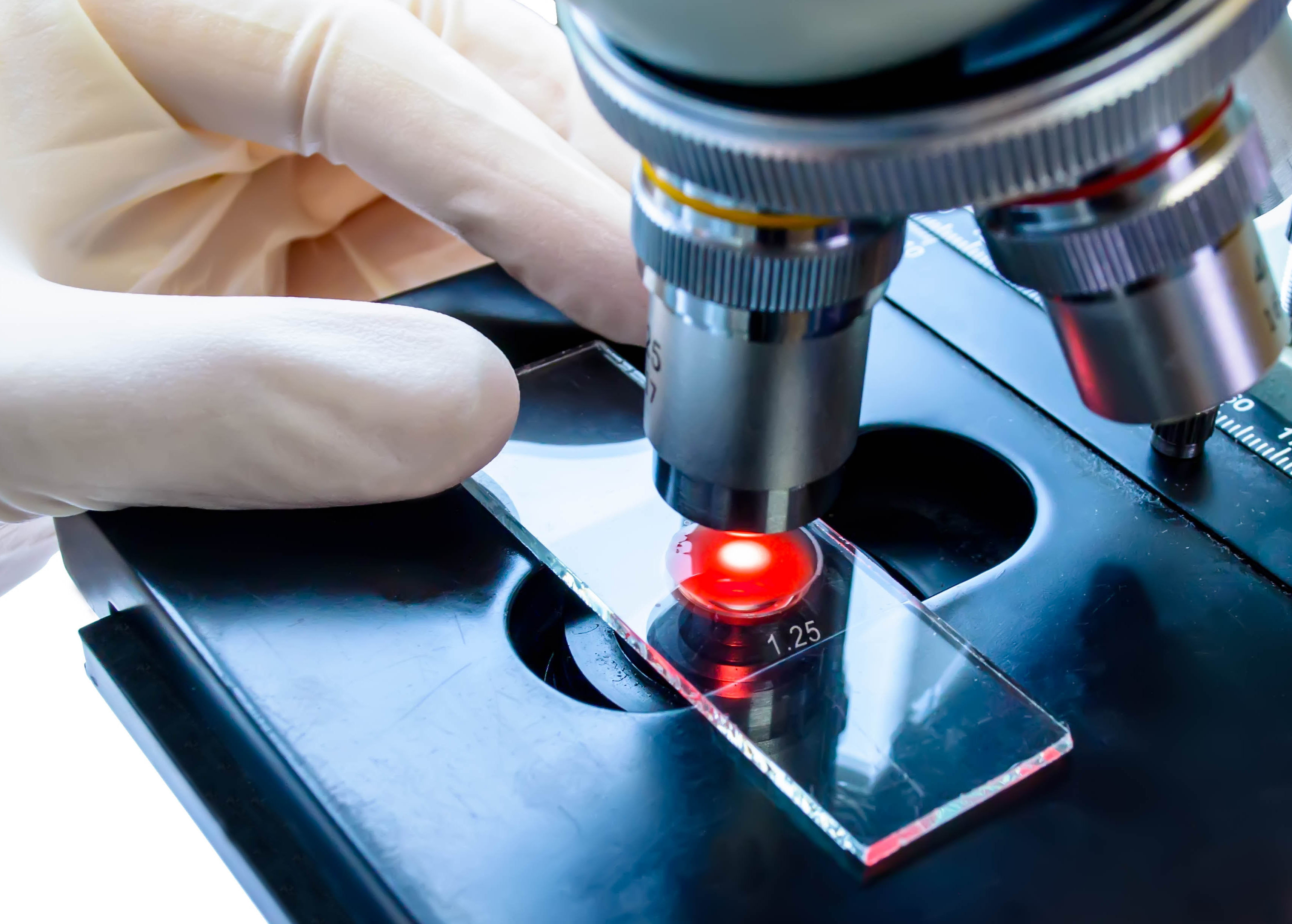 Ce nouveau test mol&eacute;culaire permet de doubler la capacit&eacute; de d&eacute;tection du cancer des voies biliaires (Visuel Adobe Stock 181330951)