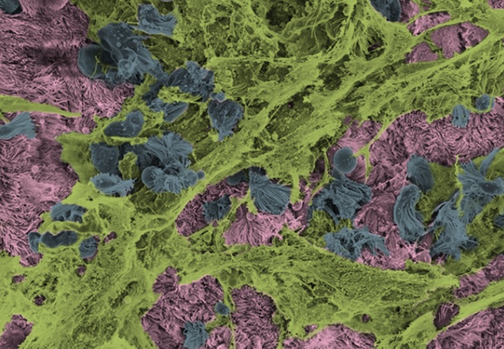 La protéine MUC5AC du mucus (en vert) protège les poumons de l’infection (Visuel Ehre Lab (UNC-Chapel Hill))