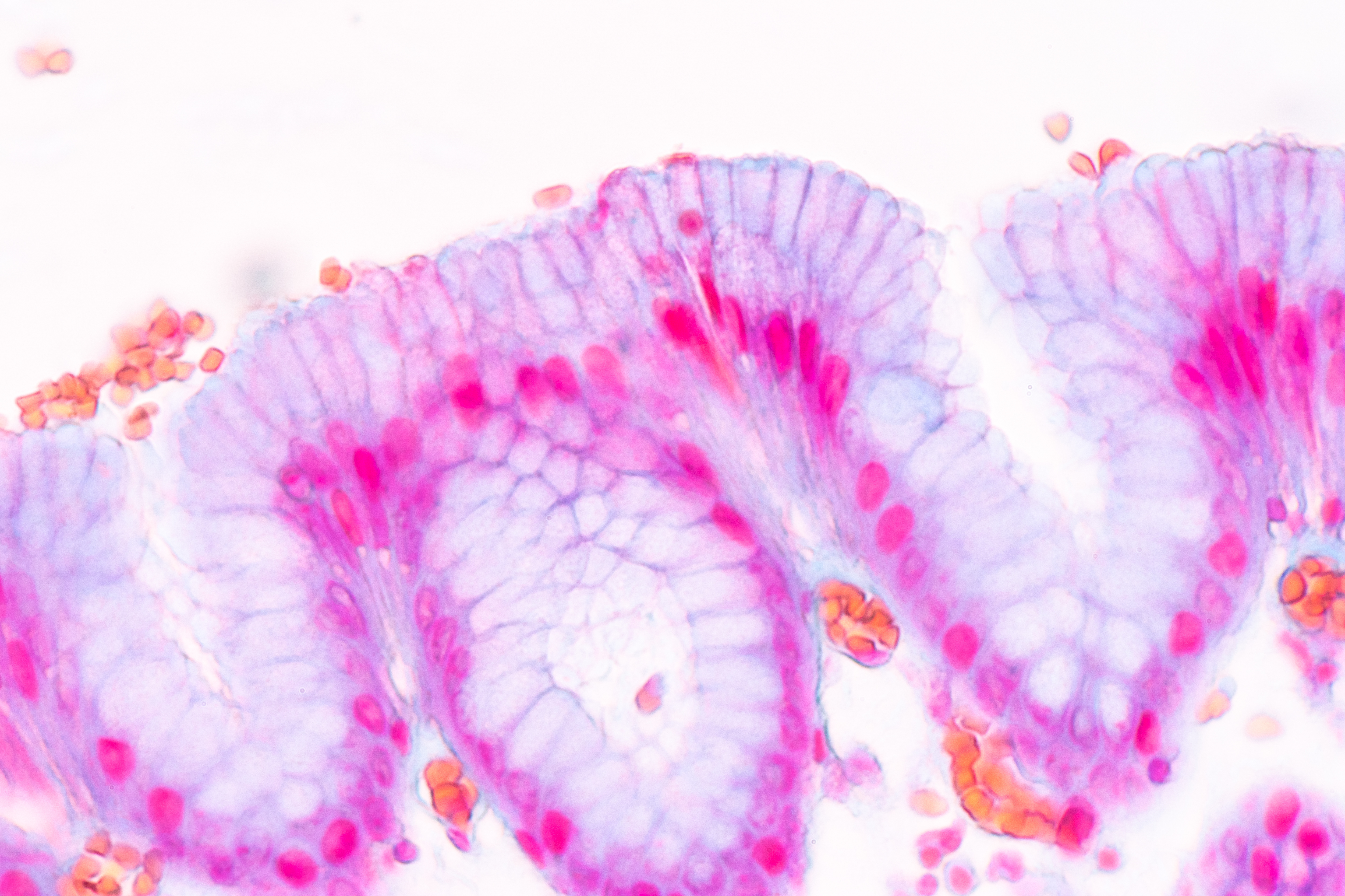 La couche superficielle de la muqueuse, appelée épithélium, « se ressaisit », via ses centaines voire milliers de cellules épithéliales en se contractant rapidement lorsqu'elle reconnaît une attaque bactérienne (Visuel Fotolia)