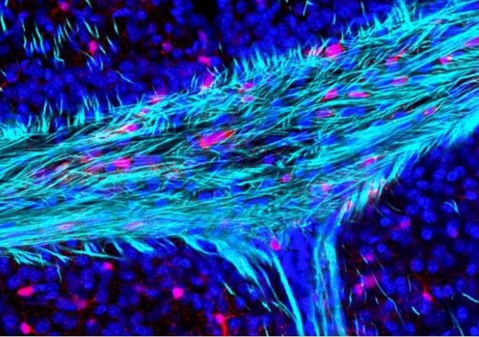 La perte de la myéline en cause dans les maladies démyélinisantes apparaît également  comme un facteur majeur de détérioration du cerveau liée à l'âge (Visuel Dr Andrea Rivera). 