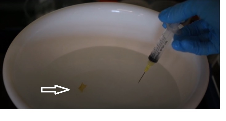 Ces films ultra-minces peuvent être injectés à l’aide de seringues donc de manière extrêmement peu invasive Ces films ultra-minces peuvent être injectés à l’aide de seringues donc de manière extrêmement peu invasive
