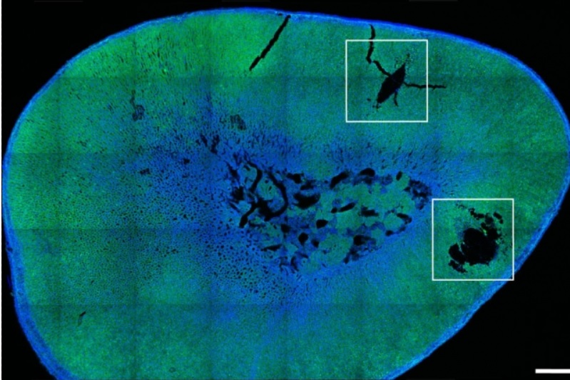 La technologie permet de contrôler à distance la libération de ces hormones par la glande surrénale, à l'aide de nanoparticules 